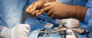 Chirurgie Generale