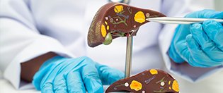 Hepato Gastro Enterologie